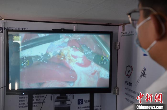 8月20日，工作人员正在通过屏幕远程密切关注5G机器人手术进展情况。　李亚龙 摄
